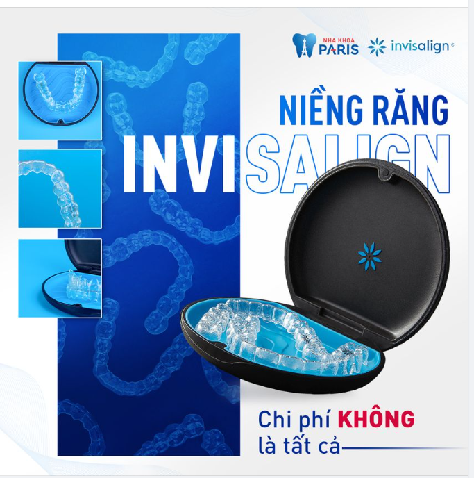 Quy trình niềng răng chuẩn hạng Kim Cương Invisalign