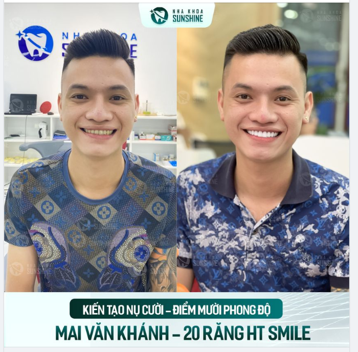 RĂNG ĐẸP CHO NỤ CƯỜI CUỐN HÚT, PHONG ĐỘ