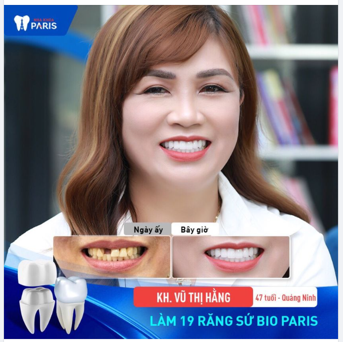 Răng đẹp yêu kiều, chồng chiều hết ý!