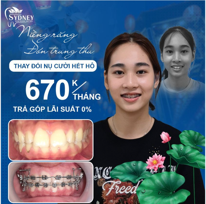 RẠNG RỠ NỤ CƯỜI - SÁNG NGỜI THẦN THÁI
