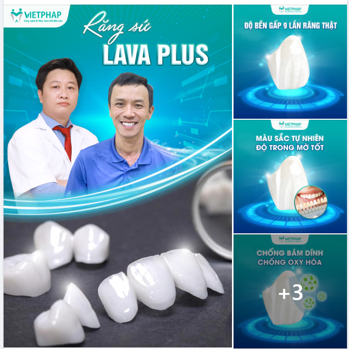 RĂNG SỨ LAVA PLUS – GIẢI PHÁP ĐEM ĐẾN NỤ CƯỜI HOÀN MỸ CHO KHÁCH HÀNG