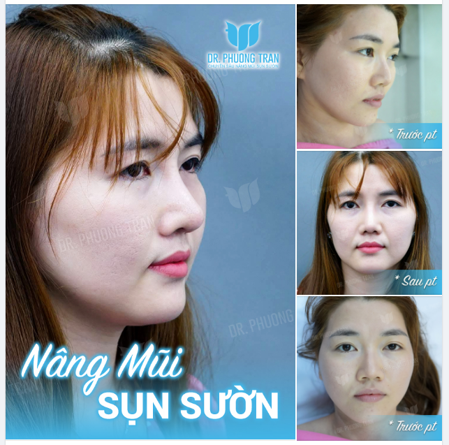 Sản phẩm này mong manh dễ vỡ. Xin vui lòng nâng đỡ yêu thương…!