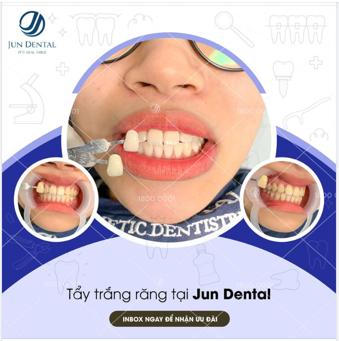 Sáng sớm đã có khách hàng đến Tẩy Trắng Răng rồi đây ạ.