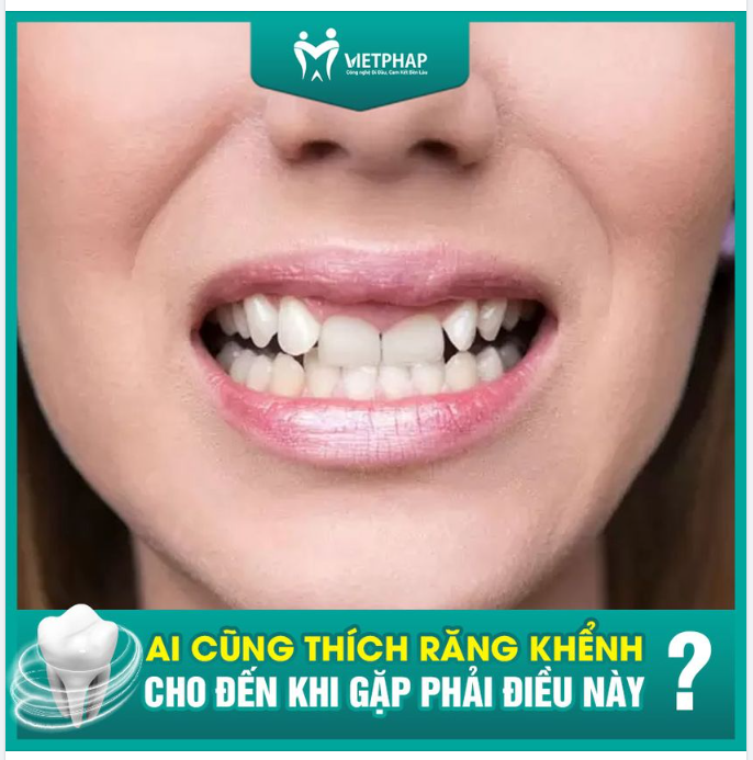 SAO VIỆT PHÁP HAY RA DẺ QUÁ!!! RĂNG KHỂNH ĐANG ĐẸP MÀ CŨNG BẢO NIỀNG