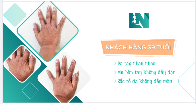 SỞ HỮU ĐÔI TAY THON NUỘT MỀM MẠI SAU 45 PHÚT Ở TUỔI 39.