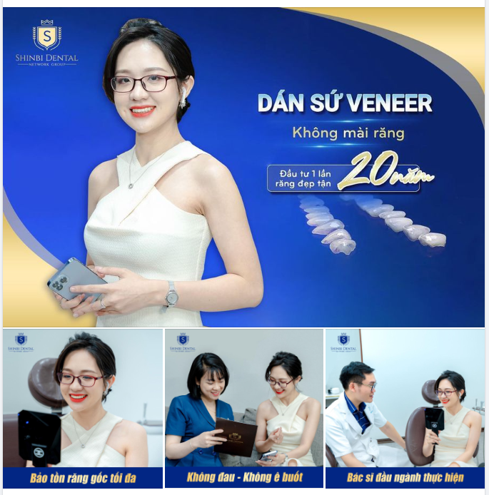 SỞ HỮU NỤ CƯỜI VẠN NGƯỜI MÊ NHỜ DÁN SỨ VENEER