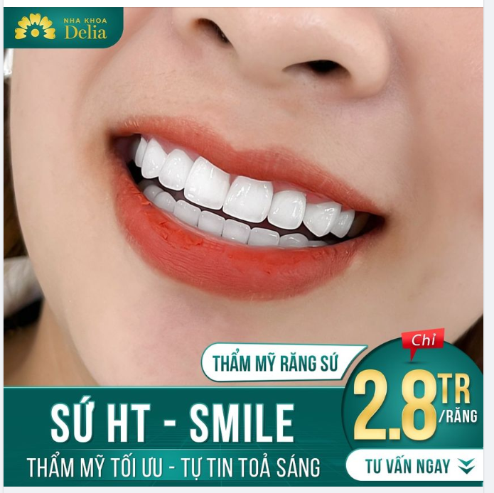 Sứ Cao Cấp HT SMILE - Chuẩn Mực Răng Sứ Tự Nhiên
