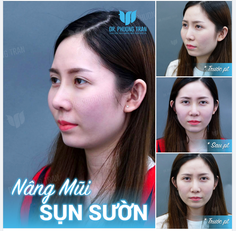 Sự lựa chọn của bạn……đôi khi phải đấu tranh và đánh đổi mới có được.