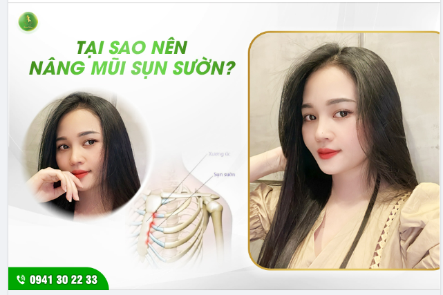 TẠI SAO NÊN NÂNG MŨI SỤN SƯỜN TỰ THÂN