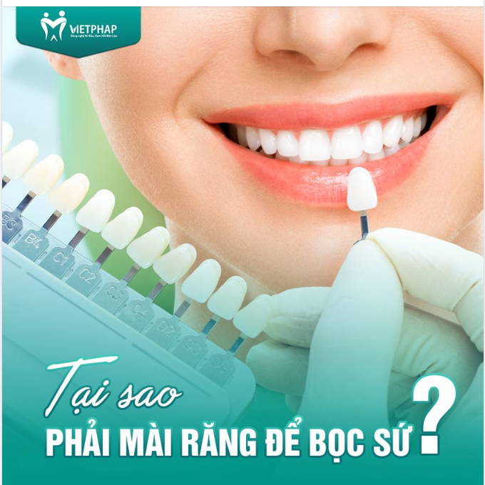 TẠI SAO PHẢI MÀI RĂNG ĐỂ BỌC SỨ?