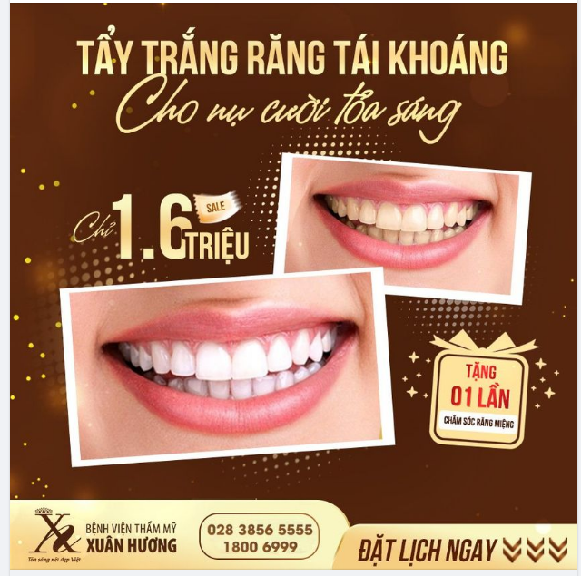 TẨY TRẮNG RĂNG TÁI KHOÁNG - CHO NỤ CƯỜI TỎA SÁNG