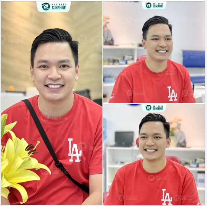THẨM MĨ RĂNG SỨ NỤ CƯỜI KHÔNG TUỔI