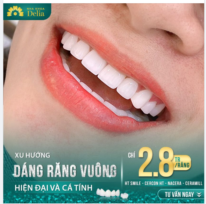 Thẩm mỹ răng sứ dáng răng vuông - Form răng tinh tế được ưa chuộng tại Delia