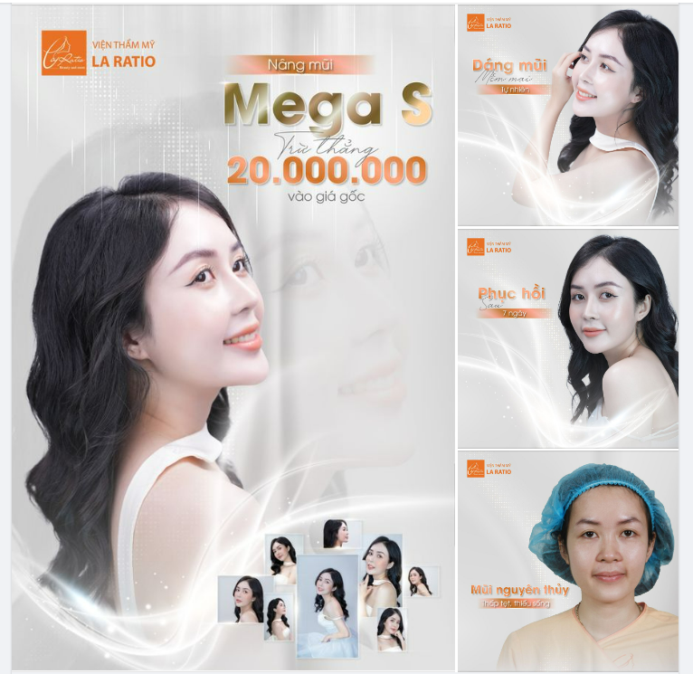 THĂNG HẠNG NHAN SẮC CÙNG NÂNG MŨI CẤU TRÚC MEGA S - NHẬN NGAY 20 TRIỆU TIỀN MẶT!