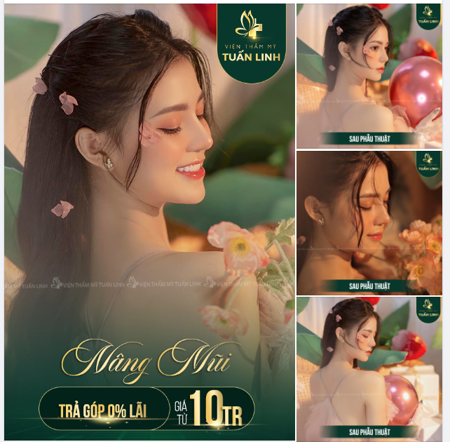 THĂNG HẠNG NHAN SẮC NHỜ DÁNG MŨI XINH.