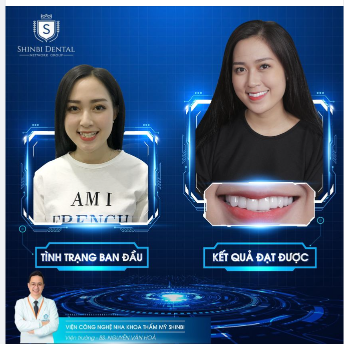THĂNG HẠNG NHAN SẮC VỚI NỤ CƯỜI THƯƠNG HIỆU SHINBI