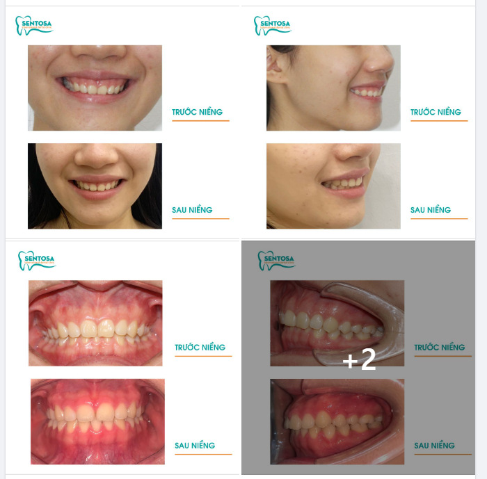 THĂNG HẠNG NỤ CƯỜI, TỰ TIN RẠNG NGỜI