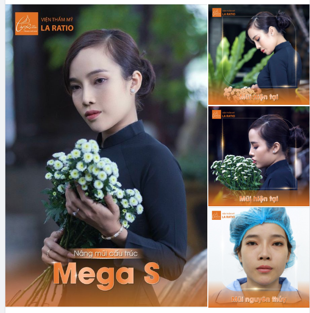 Thanh thoát và tự nhiên hơn với dáng mũi Mega S