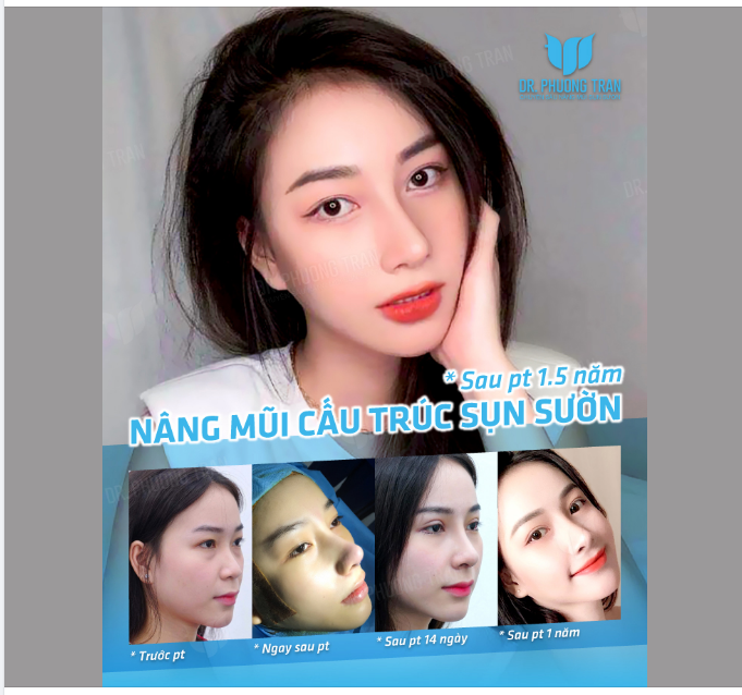 Thanh xuân như một tách trà. Mình hay uống rượu nên trà còn nguyên…!