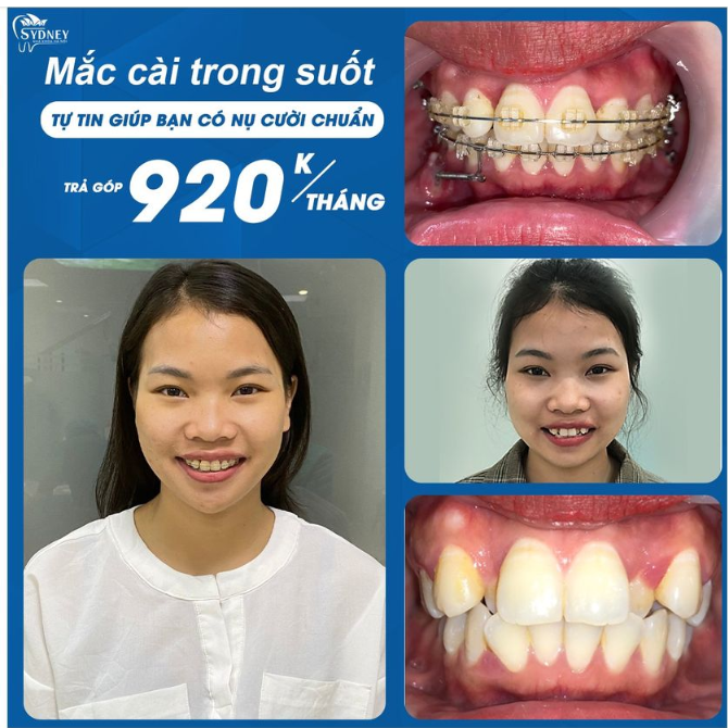 Thật lãng phí một ngày nếu không có tiếng cười