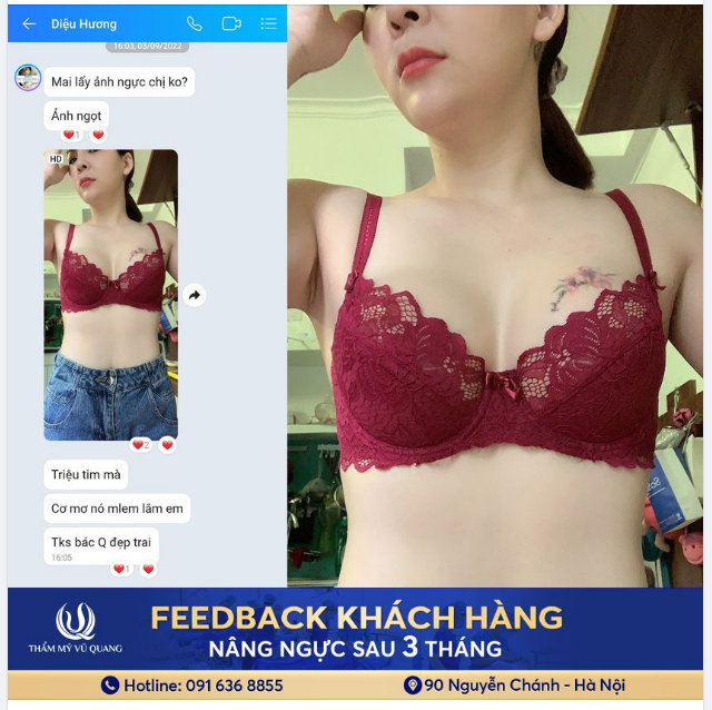 Thêm 7 phần xinh đẹp và 3 phần hạnh phúc khi sở hữu vòng 1 quyến rũ từ Thẩm mỹ Vũ Quang.