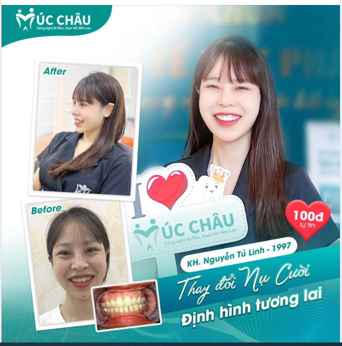 THIẾT KẾ NỤ CƯỜI – ĐỊNH HÌNH TƯƠNG LAI