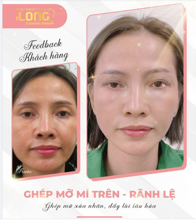 Thời gian trôi qua dù là bao nhiêu năm gặp lại vẫn khiến người quen phải thốt lên “sao ngày càng trẻ đẹp thế này”. Đó là điều hạnh phúc đối với phụ nữ.