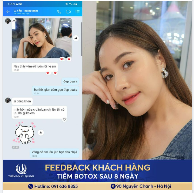 Tiêm botox gọn hàm tại Thẩm mỹ Vũ Quang chưa bao giờ làm ai thất vọng