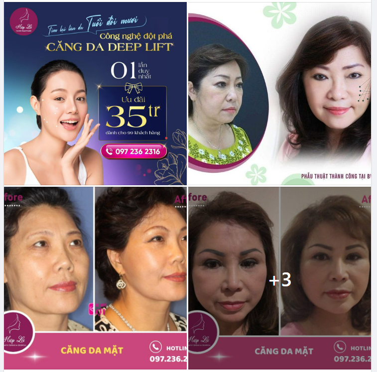 TÌM LẠI SỰ TƯƠI TRẺ CHO LÀN DA CÙNG CÔNG NGHỆ DEEP LIFT MỚI