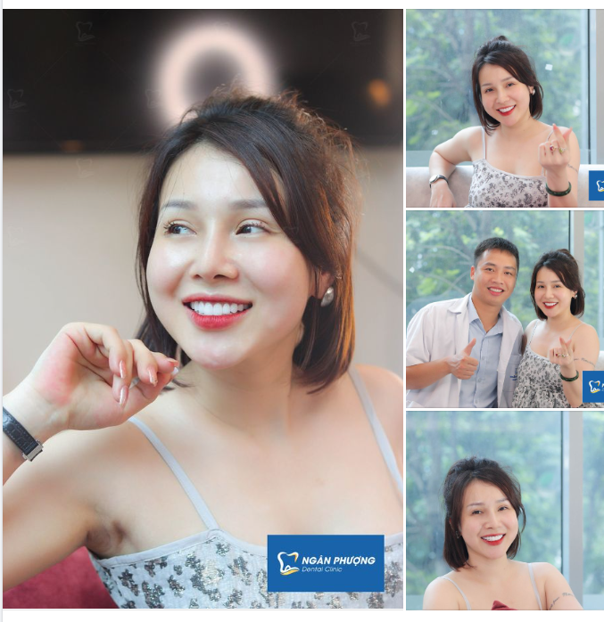 Trăng tròn 0 khuyết - Răng đẹp 10 điểm