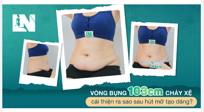 TRỌN VẸN THANH XUÂN CHO KH 9X, BỤNG 103CM SAU SINH.