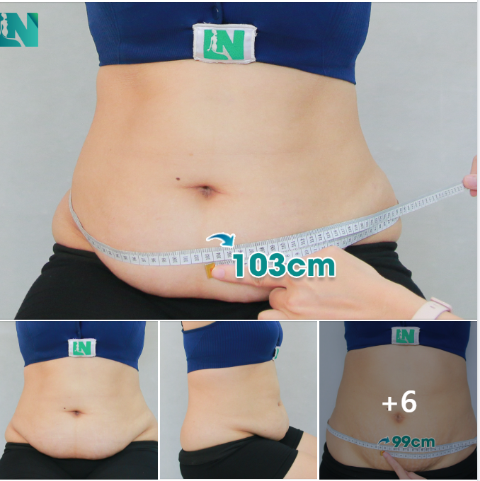 TRỌN VẸN THANH XUÂN CHO KH 9X, BỤNG 103CM SAU SINH.