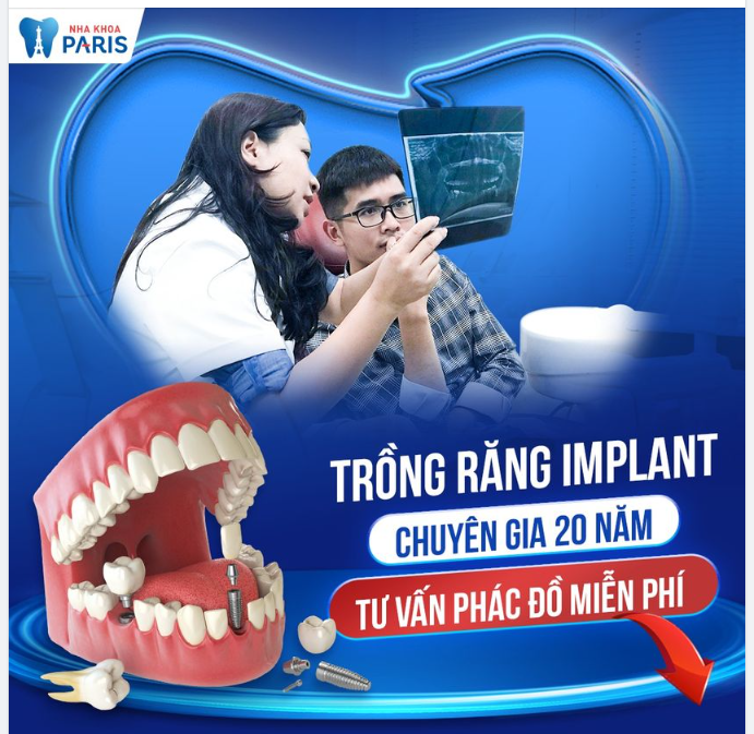 TRỒNG RĂNG IMPLANT - CHUYÊN GIA NÀO THỰC HIỆN?