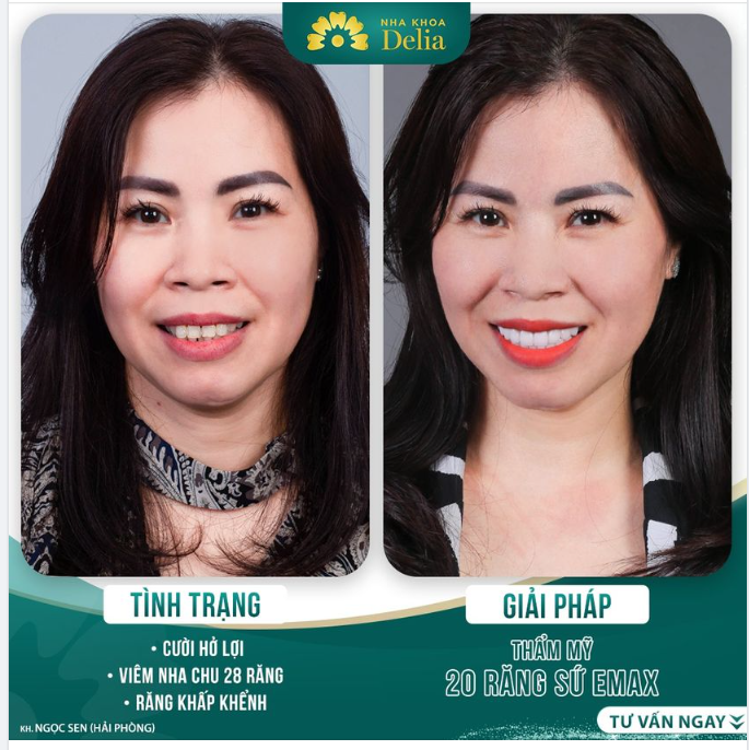 Từ Hải Phòng lên Hà Nội thẩm mỹ răng sứ và cái kết mỹ mãn