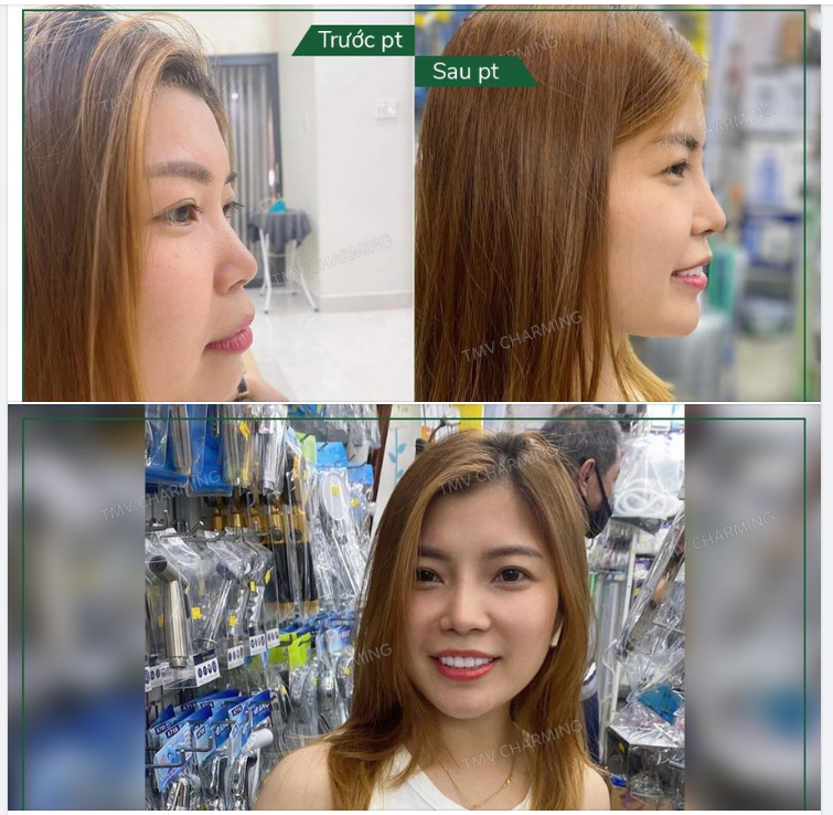 Tự nhiên và tự tin là những gì mà Charming mong muốn mang lại cho mỗi khách hàng. Bạn khách này là một ví dụ điển hình cho giá trị đó.