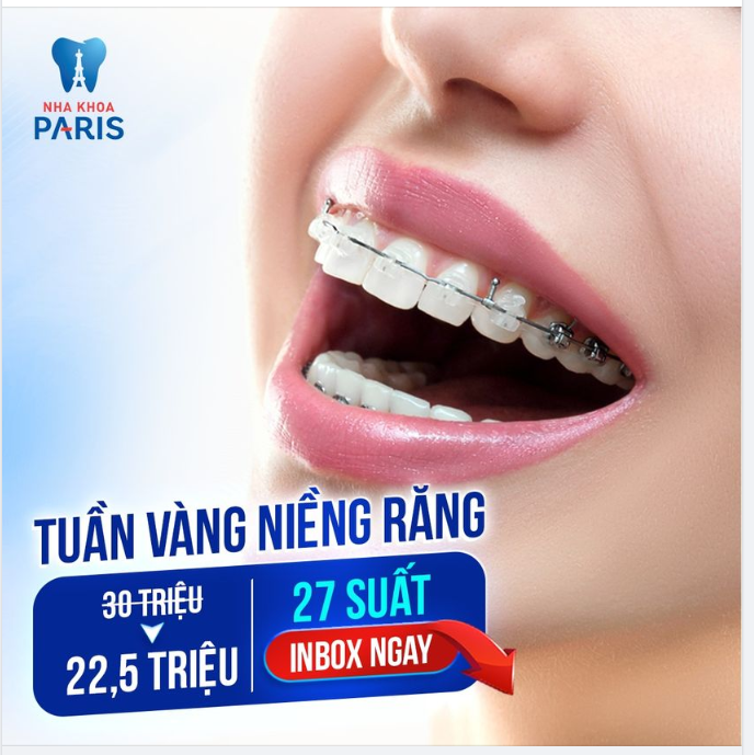 TUẦN VÀNG SĂN SALE NIỀNG RĂNG