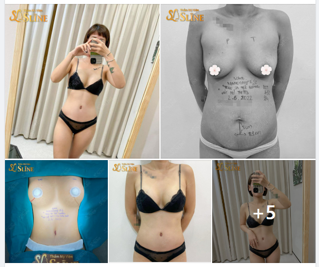 u là trời điêu khắc body là đây chứ đâu. chị khách hàng thực hiện combo dịch vụ làm đẹp