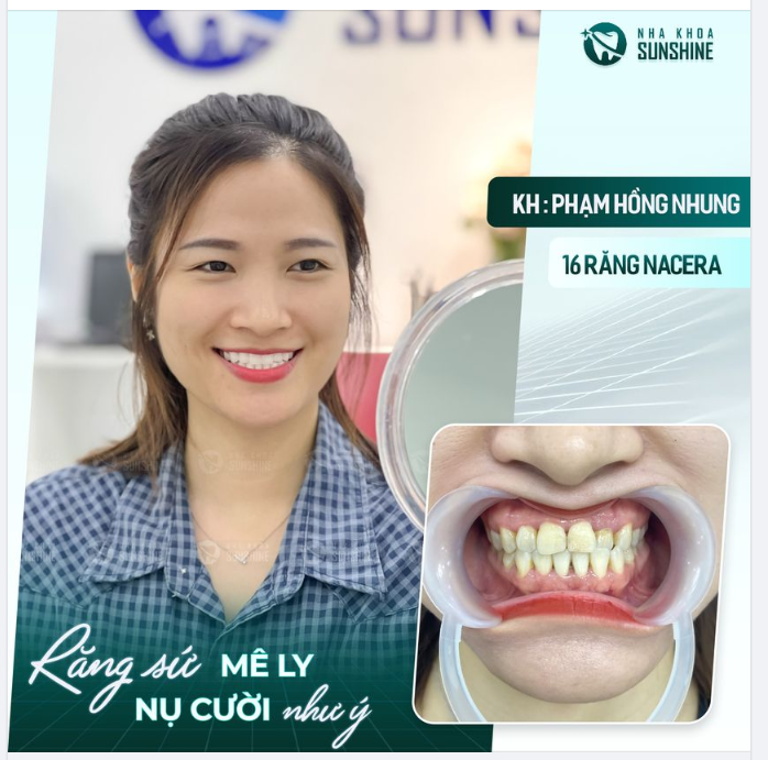 ƯU ĐÃI TẠI SUNSHINE