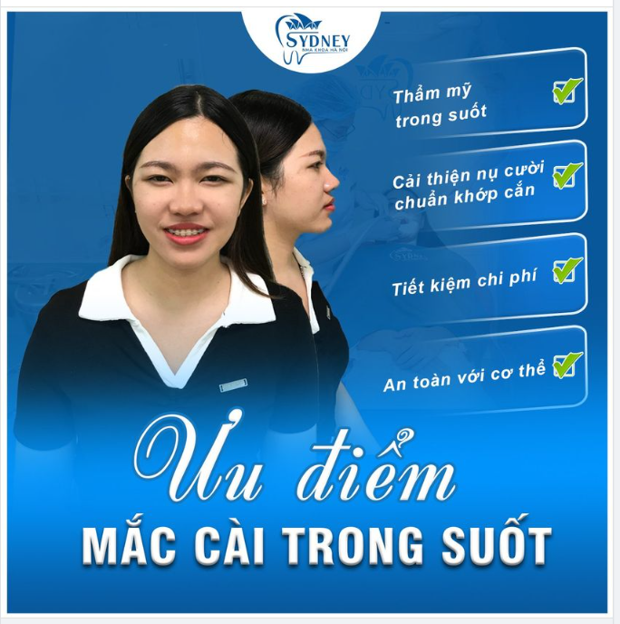 Ưu điểm của mắc cài trong suốt