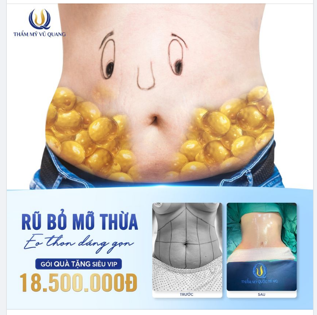 Vì BÉO nên mặc gì cũng XẤU