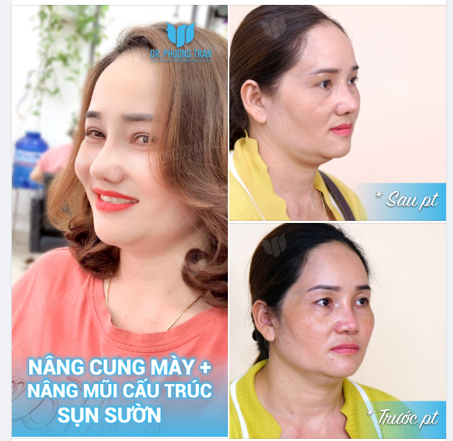 Vì thanh xuân ngắn lắm Chớ phí hoài em nghe…!