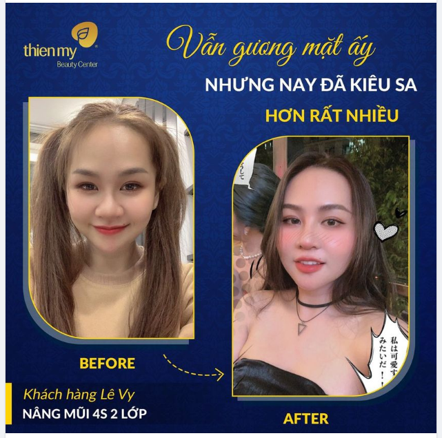 Viện Thẩm mỹ Thiện Mỹ luôn hướng khách hàng đến nét đẹp cân đối, tự nhiên, hài hoà với gương mặt sẵn có!