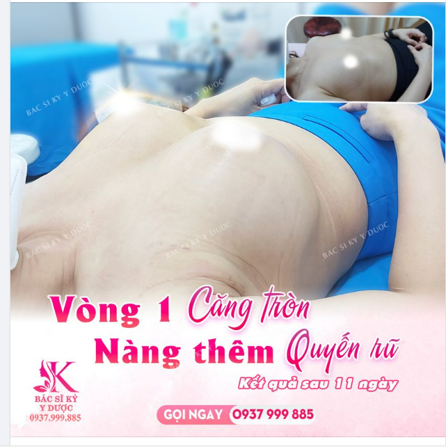VÒNG 1 CĂNG TRÒN - VẠN NGƯỜI ĐẮM SAY