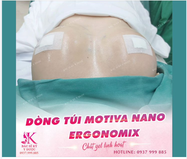 VÒNG 1 ĐẲNG CẤP - DÒNG TÚI CỰC ĐỈNH
