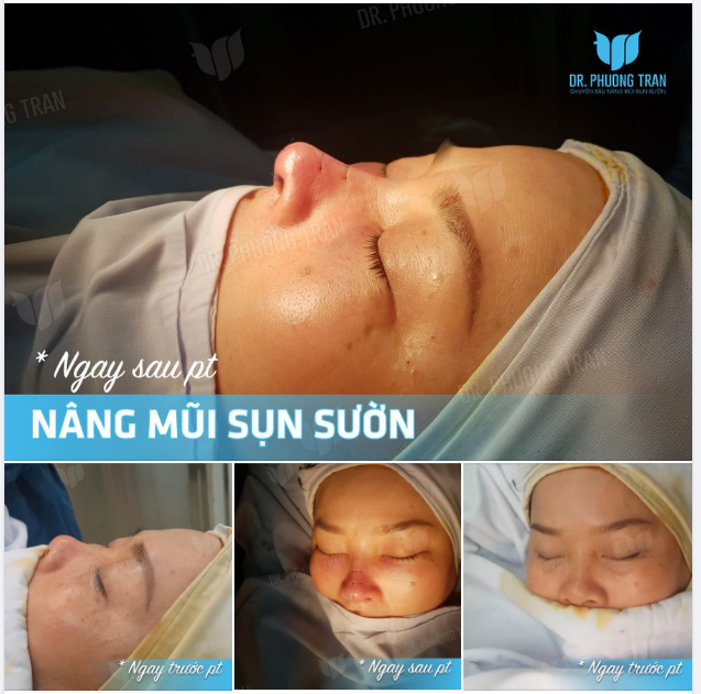 VỪA XONG…ĐỂ LẠI MỘT NHẬN XÉT CỦA BẠN NÀO…