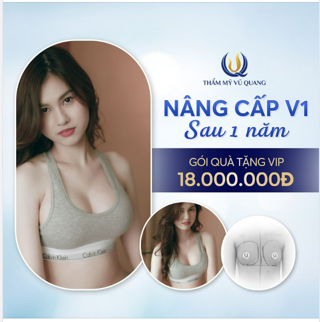 Vượt lên số phận LÉP BẨM SINH