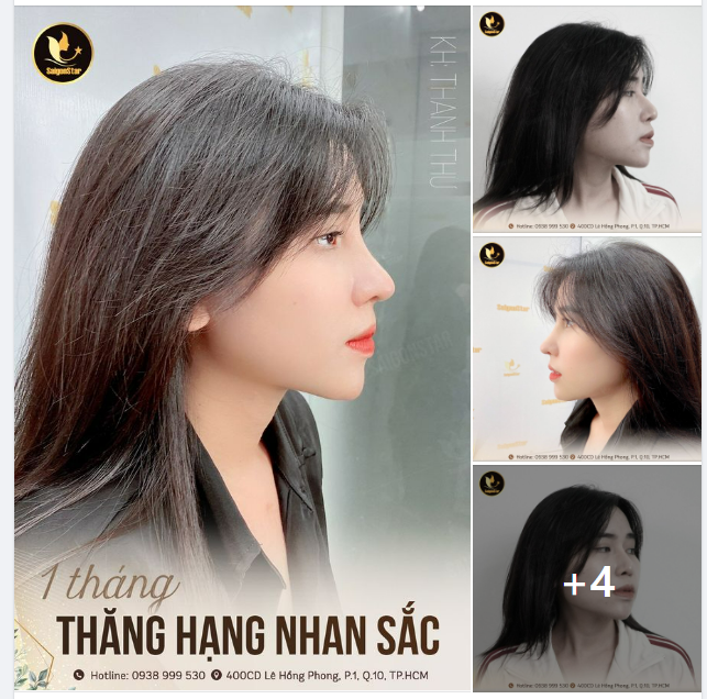 1 THÁNG THĂNG HẠNG NHAN SẮC VỚI MŨI CẤU TRÚC