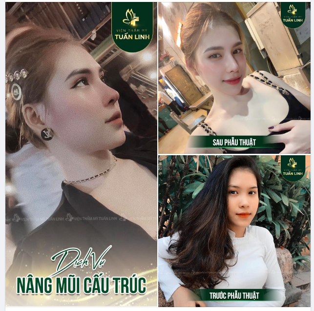 11 NGÀY NỮA LÀ 2010. THỜI GIAN VỪA ĐỦ ĐỂ ''NẶN'' MỘT CHIẾC MŨI XINH CHƠI LỄ ĐÓ Ạ!!