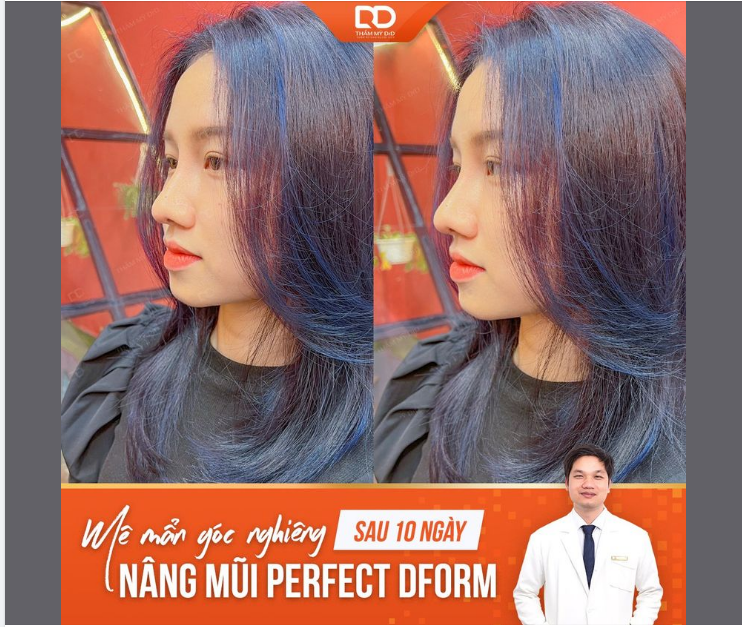 2 ,3 CON MỰC, GÓC NGHIÊNG ĐẸP CỰC
