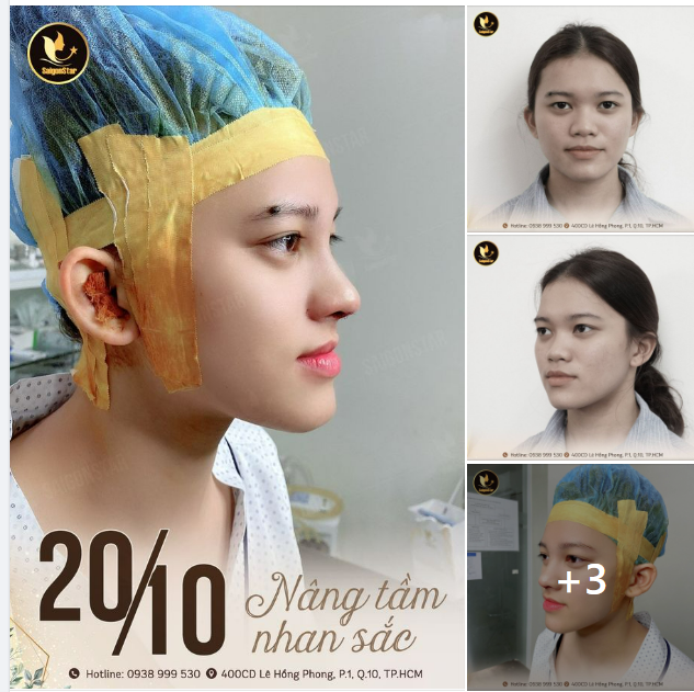 20/10 – NÂNG TẦM NHAN SẮC CÙNG DR. HOẠT